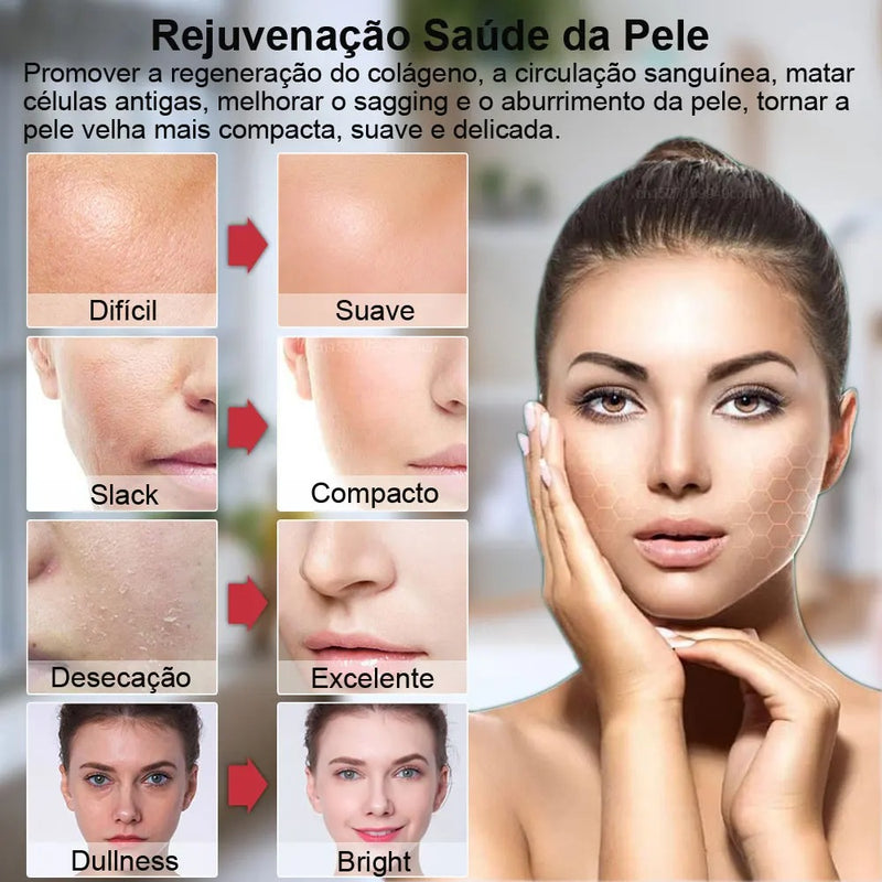 Massageador Facial Lifting Rejuvenescimento